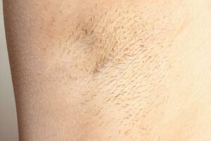 hairy armpit female closeup dark hair growing under arm before hair removal photo