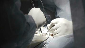 Close up of procedure is being carried out on a patient with professional equipment. Action. Surgeons hands operating patient in the clean room, concept of health and medicine. photo