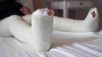 weinig kind met gips verband Aan been. video