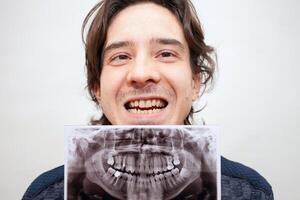 radiografía de dientes fotografía. hombre sonrisas, abre su boca. posa, retrato. blanco antecedentes foto