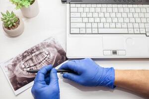 dentista en clínica examina radiografía de mandíbula de clientela del paciente dientes. moderno tecnologías. cerca arriba foto