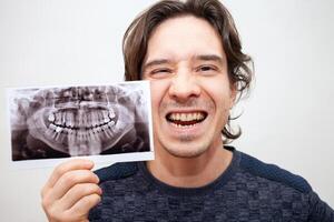 radiografía de dientes fotografía. hombre sonrisas, abre su boca. posa, retrato. aislado foto