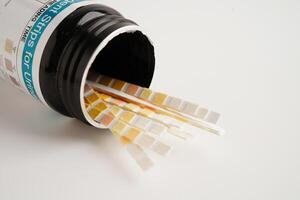 Urinalysis, urine cup with reagent strip pH paper test and comparison chart in laboratory. photo