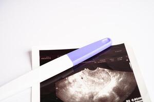 Pregnancy test with ultrasound scan photo of fetus, maternity, childbirth, birth control.