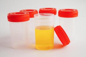 Urinalysis, urine cup for check health examination in laboratory. photo