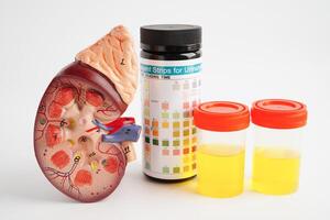 Urinalysis, Kidney and urine cup for check health examination in laboratory. photo