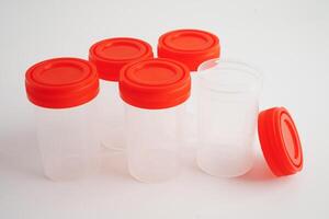 Urinalysis, urine cup for check health examination in laboratory. photo