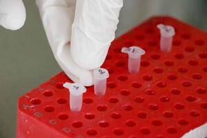Different activities of PCR testing for virus recognition photo