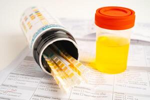 Urinalysis, urine cup with reagent strip pH paper test and comparison chart in laboratory. photo