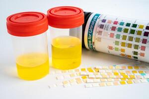 Urinalysis, urine cup with reagent strip pH paper test and comparison chart in laboratory. photo