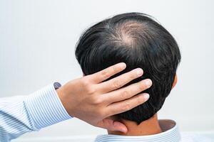 calvo en la cabeza media y sin pérdida de cabello glabro de hombre de oficina activo inteligente de negocios asiáticos maduros. foto