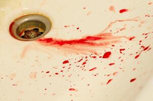 gotas de sangre manchado lavabo foto