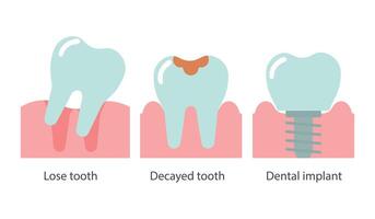 Dentistry, icons set. Lost tooth, decayed tooth, implant. Medical concept. Vector