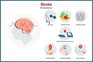 Medical illustration, educational vector illustration in flat style of prevention of stroke, exercise, limited alcohol, eating healthy foods, stop smoking, manage diabetes, control blood pressure.