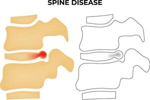 Spine Disease Science Design Vector Illustration Diagram