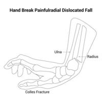 B251epHand Break Painfulradial Dislocated Fall Science Design Vector Illustrations