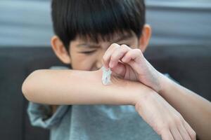 pequeño asiático Niños manos peladura apagado seco piel en su brazo. piel problemas. foto