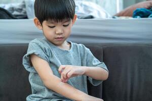 Little Asian boy's hands peeling off dry skin on his arm. Skin problems. photo