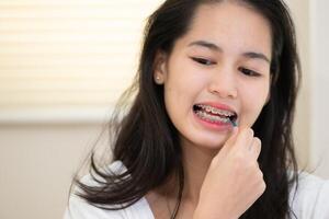 Portrait of a young asian woman with braces on her teeth photo