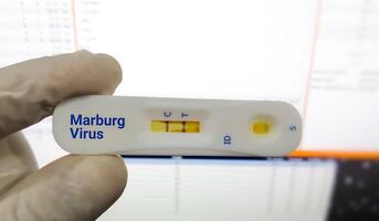 Rapid test cassette for the virus - Marburg, Medicine and health concept photo