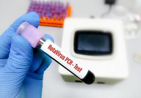 Blood sample for Rota virus PCR test photo