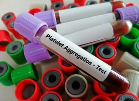 sangre muestra para plaqueta agregación prueba foto