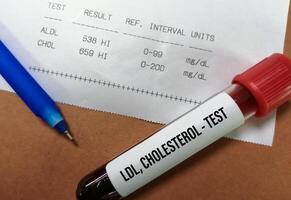 Blood sample with abnormal high report of Total Cholesterol and LDL cholesterol test. photo