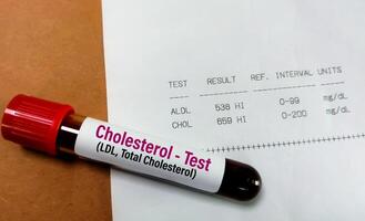 Blood sample with abnormal high report of Total Cholesterol and LDL cholesterol test. photo