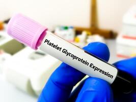 Platelet Glycoprotein Expression Test, for diagnosis of various hereditary or acquired platelet disorders including Bernard-Soulier syndrome or Glanzmann thrombasthenia. photo