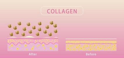 colágeno , antes de y después proceso de consiguiendo piel, proteccion piel vector