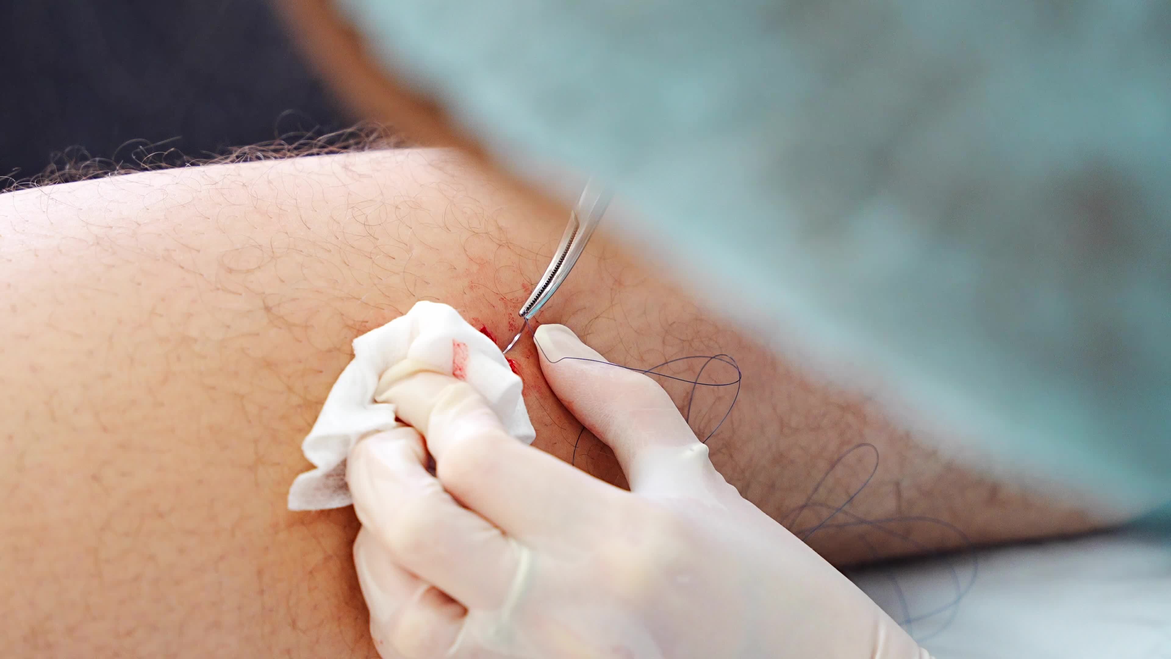 Weeping Wounds: A Dermatologist'S Perspective - j54w0li