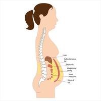 Visceral fat and subcutaneous fat accumulate around organs. Medicine and health diagram about belly fat. vector