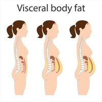 Visceral fat and subcutaneous fat accumulate around organs. Medicine and health diagram about belly fat. vector