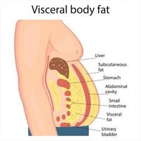 Visceral fat and subcutaneous fat accumulate around organs. Medicine and health diagram about belly fat. vector
