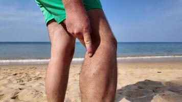 bañista gestos a pierna dolor playa, playa mosca muerde, playa pulga picaduras foto