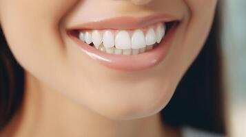 AI generated Closeup of smiling woman with healthy teeth in dental clinic, closeup photo