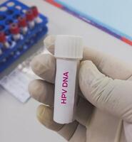 pruebas tubo con vaginal fluido muestra para hpv adn prueba, humano papiloma virus, cervical cáncer. un médico pruebas concepto en el laboratorio foto