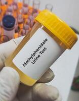 Urine sample for Methylphenidate or Retalin test. Stimulant used for attention deficit hyperactivity disorder ADHD. photo