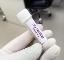 Vaginal fluid sample for CO-Testing or HPV DNA test and LBC test, Human papilloma virus, cervical cancer. A medical testing concept in the laboratory photo