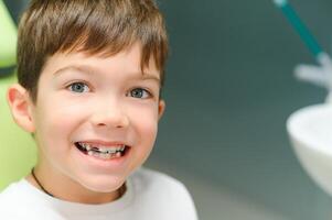 The boy inserts an orthodontic plate in his mouth photo