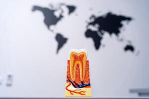 A Tooth Model with a World Map Background. A model of a tooth with a map of the world in the background photo