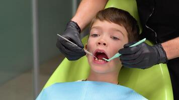 de cerca de pequeño chico apertura su boca amplio durante tratando dientes por el dentista video