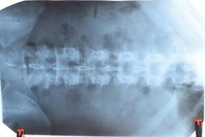 X ray of the lumbar spine, spine on x-ray photo