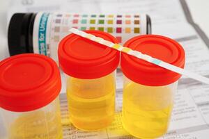 Urinalysis, pregnancy test and urine cup for female of ovulation day, fetus, maternity, childbirth, birth control. photo