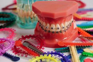 Orthodontic ligatures rings and ties, elastic rubber bands on orthodontic braces, model for dentist studying about dentistry. photo