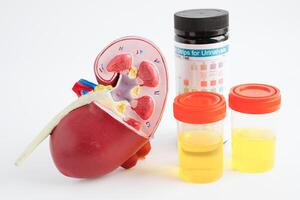 Urinalysis, Kidney and urine cup for check health examination in laboratory. photo