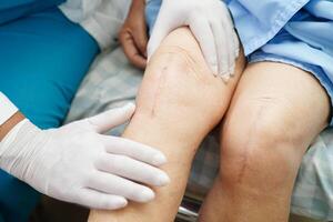 médico revisando a una anciana asiática con cirugía de reemplazo de rodilla con cicatriz en el hospital. foto
