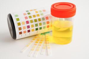 Urinalysis, urine cup with reagent strip pH paper test and comparison chart in laboratory. photo