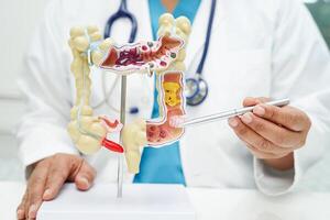 Intestine, doctor holding anatomy model for study diagnosis and treatment in hospital. photo