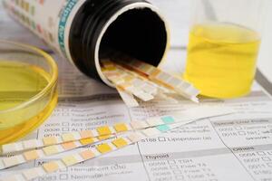 Urinalysis, urine cup with reagent strip pH paper test and comparison chart in laboratory. photo